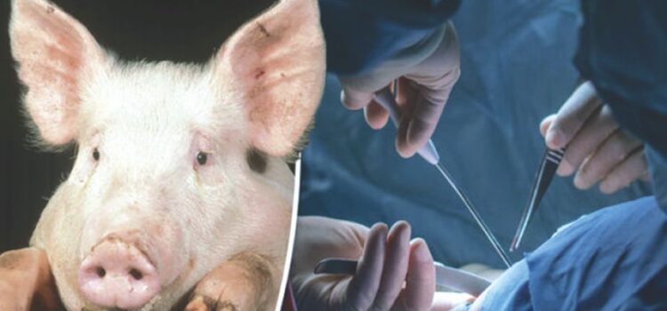 Xenotransplantation PIG TRANSPLANT